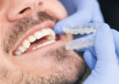 Colocación de férula de ortodoncia invisible en paciente